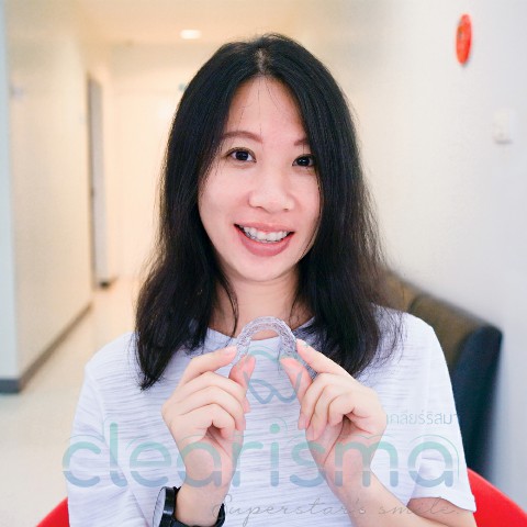 จัดฟันออนไลน์