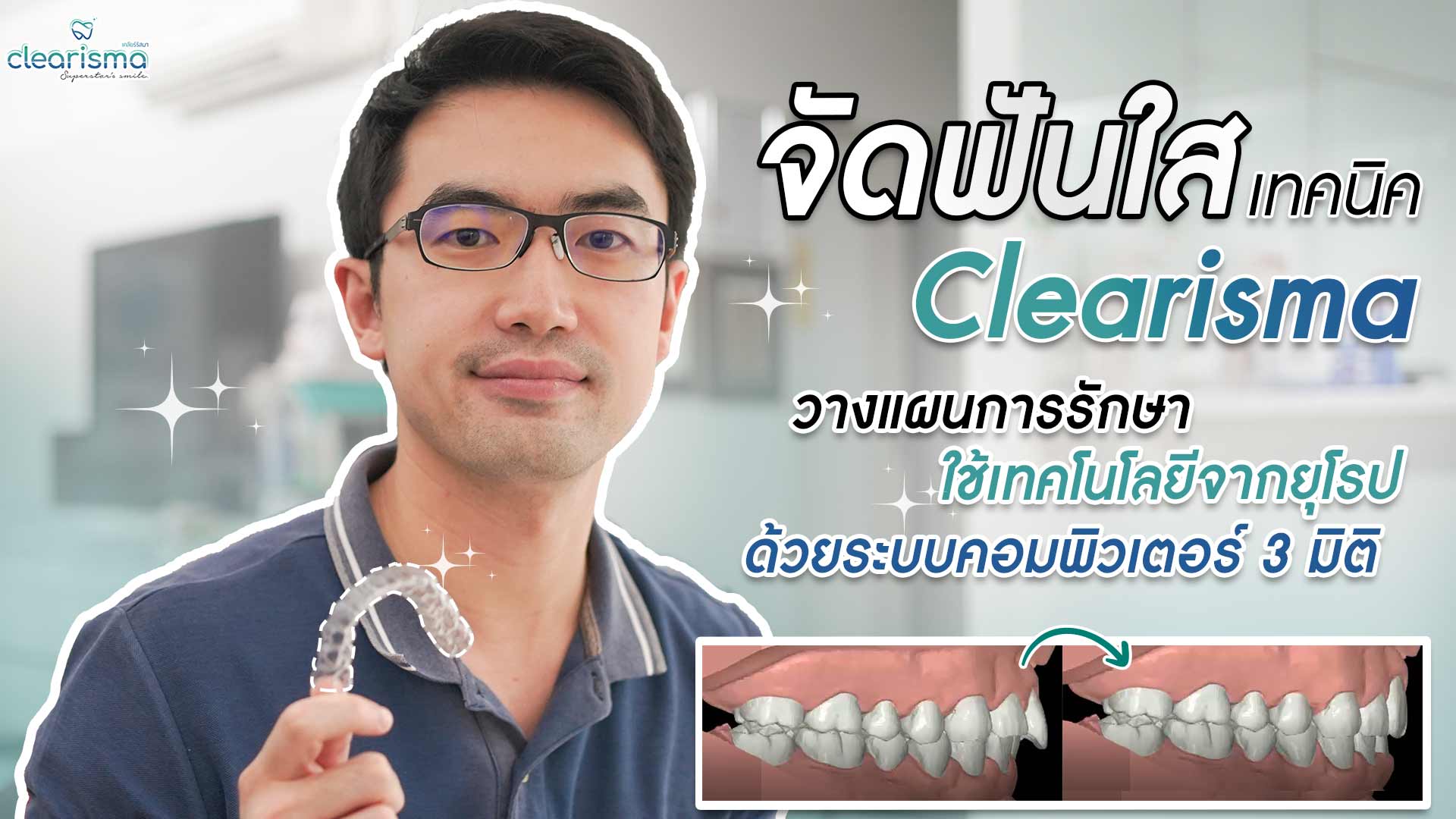 จัดฟันใสราคาถูก