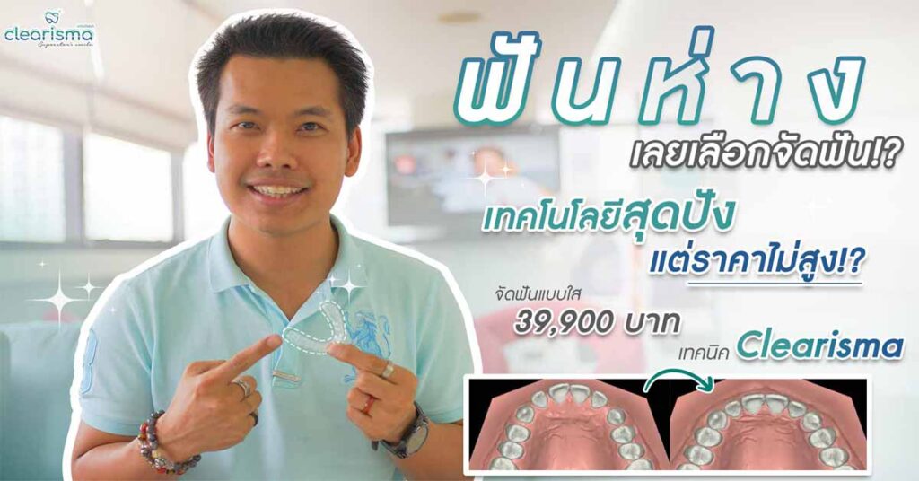 review-clear-braces-techid