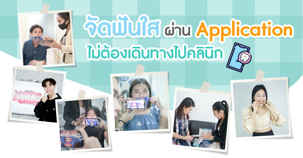 จัดฟันออนไลน์