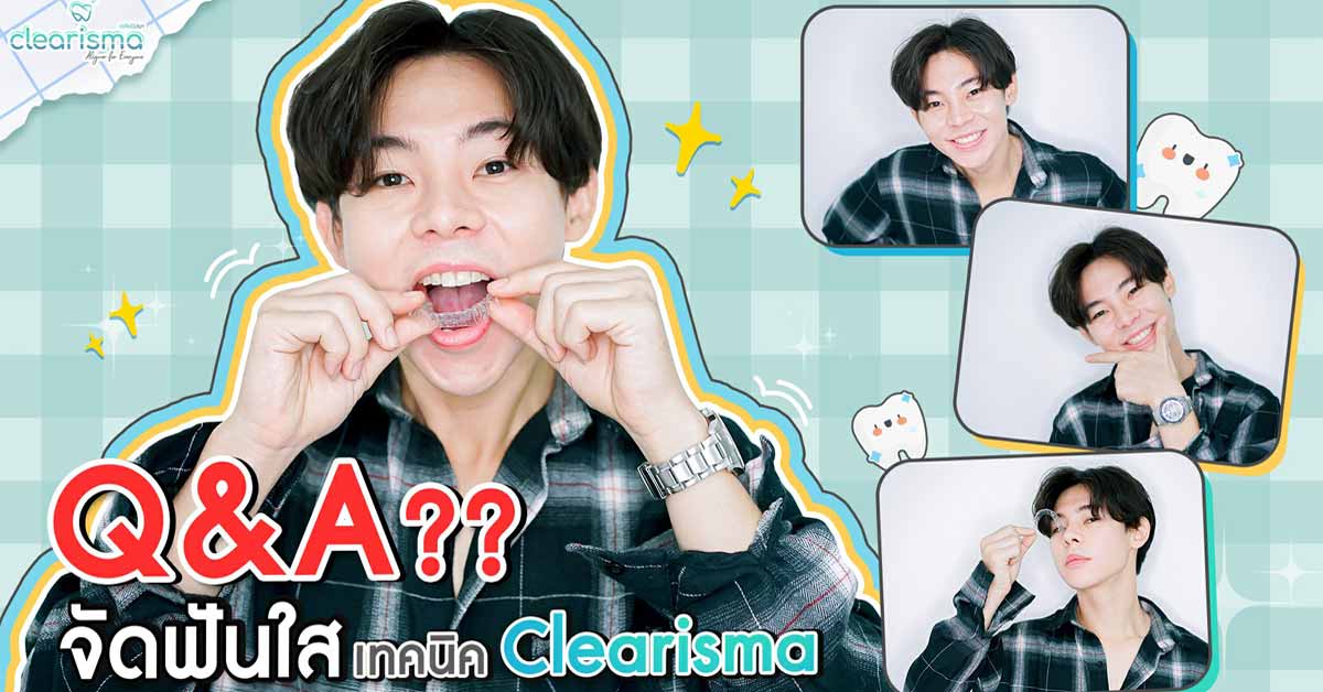[รีวิวจัดฟันใส] ถาม-ตอบ เรื่องดัดฟัน จัดฟันแบบใสกับคุณ อินทัช ณภัทร เฉลิมพรภักดี