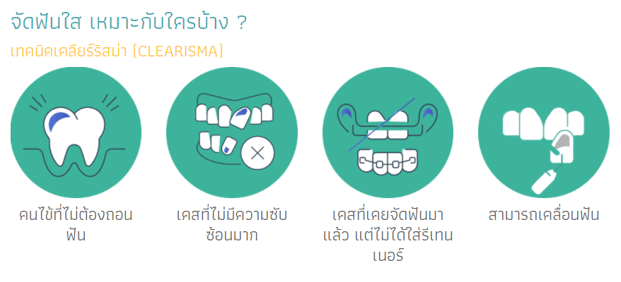 จัดฟันใส
