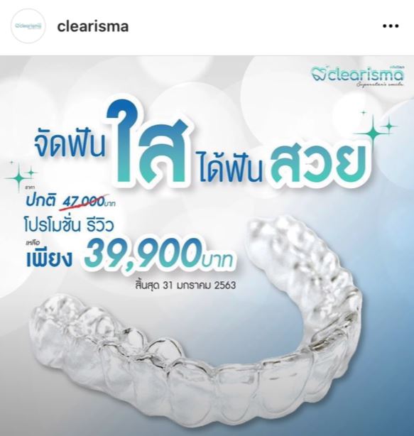 ดัดฟันใสราคา จัดฟันใสราคาถูก จัดฟันแบบใส จัดฟันใส