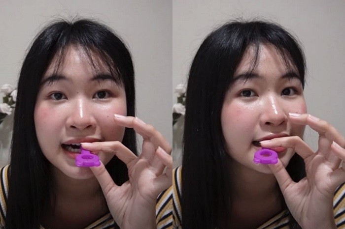 จัดฟันแบบใส ดัดฟันแบบใส จัดฟันใสราคาถูก รีวิวดัดฟันใส จัดฟันใส ดัดฟัน