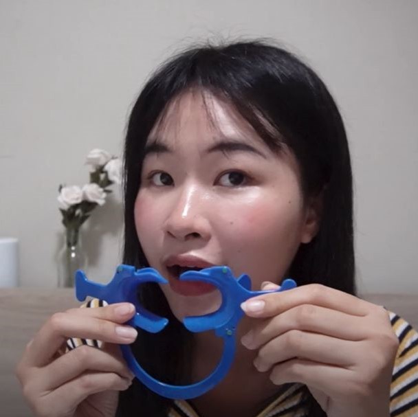 รีวิวดัดฟันแบบใส จัดฟันใสราคาถูก ดัดฟันใส จัดฟันใส ดัดฟัน จัดฟันแบบใส
