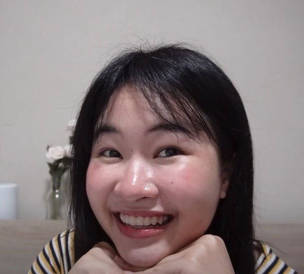 จัดฟันใสราคาถูก ดัดฟันใส จัดฟันใส รีวิวดัดฟัน จัดฟันแบบใส ดัดฟันแบบใส