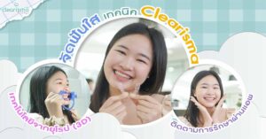 review-clearbraces-clearaligner