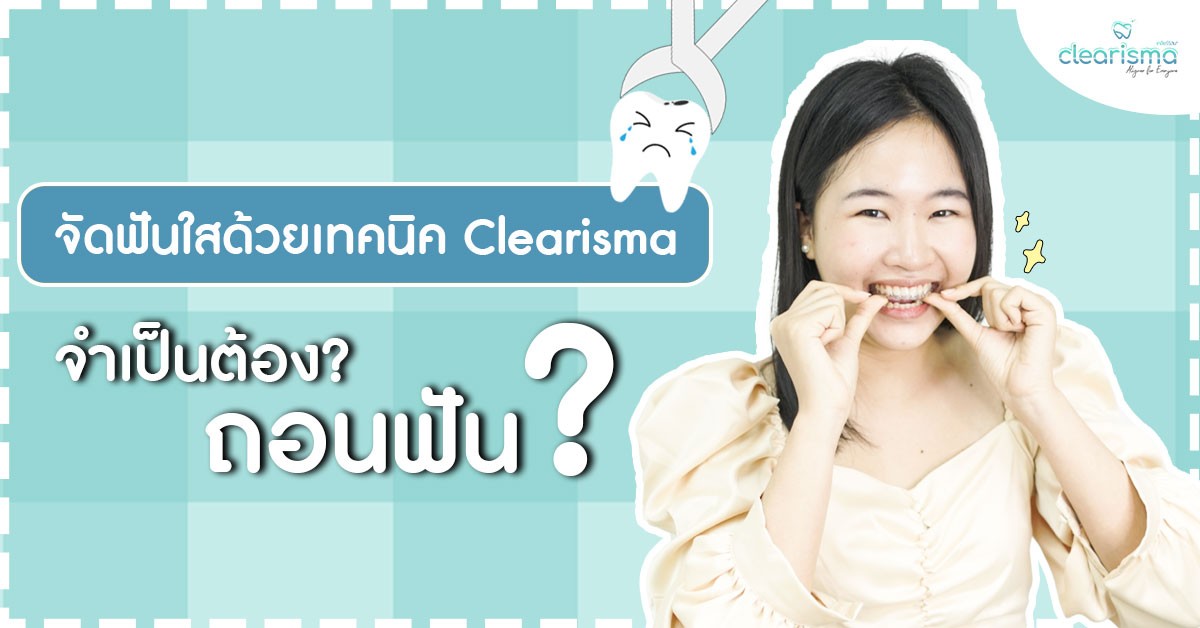 การจัดฟันแบบใส
