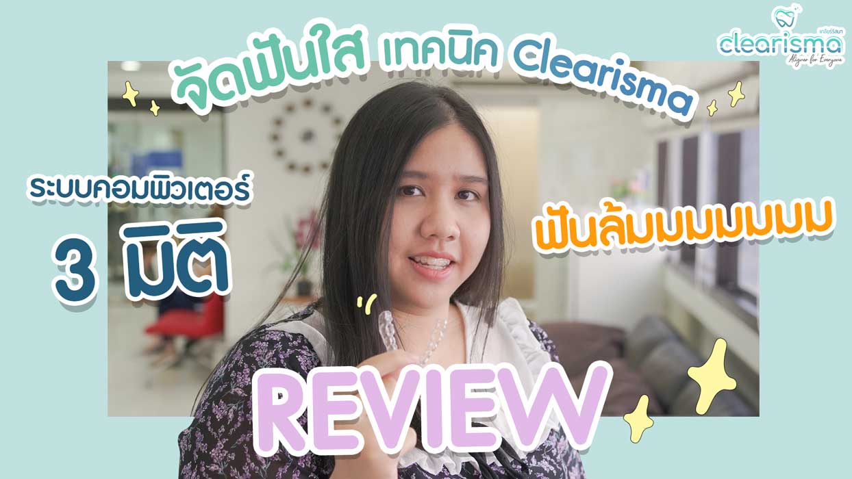 รีวิวจัดฟันรอบ 2 ด้วยการจัดฟันแบบใส Clearisma