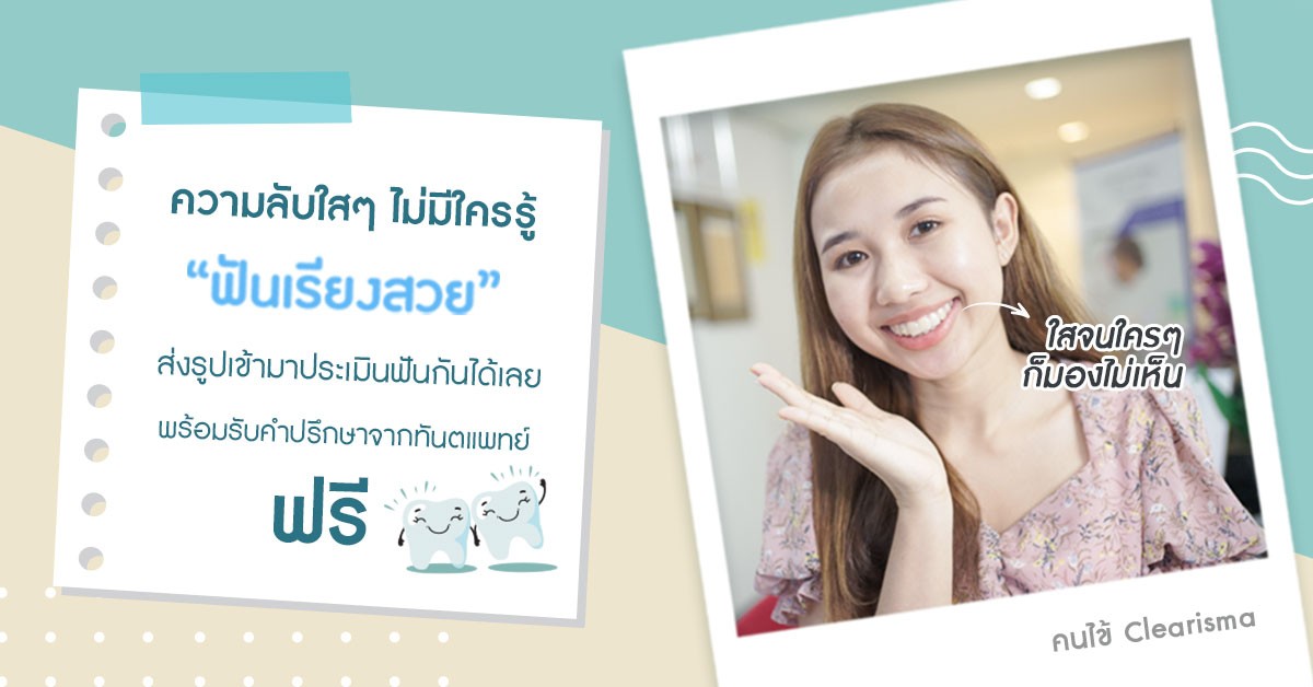 จัดฟันใส