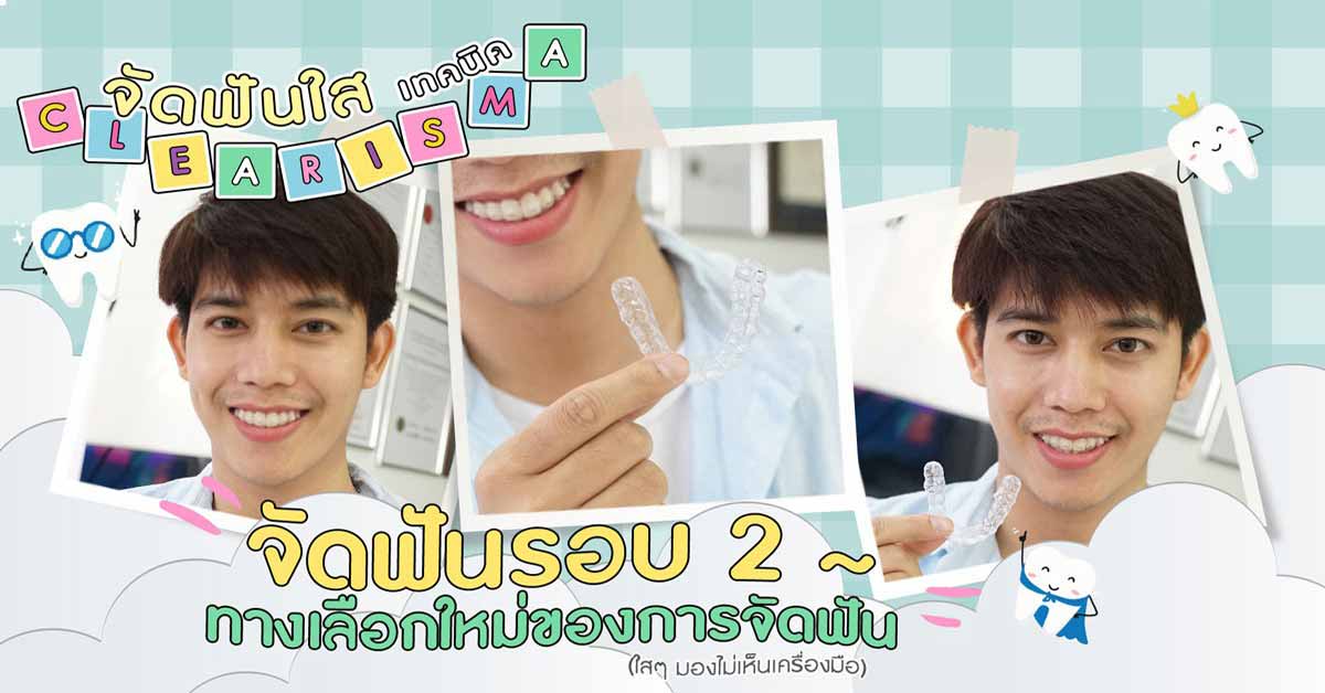 [รีวิวจัดฟันใส] “ฟันห่าง” จัดฟันรอบ 2 เลือกจัดฟันใส 39,900!? ไม่ต้องเข้าพบแพทย์ทุกเดือน