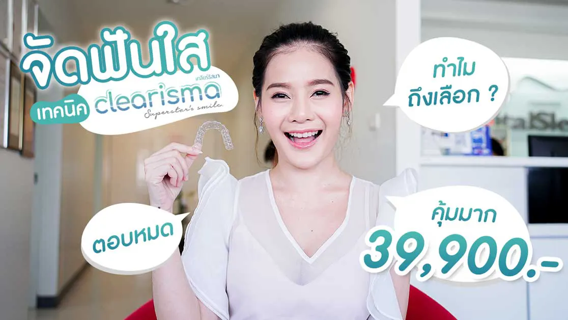 review-clearisma-clear-braces