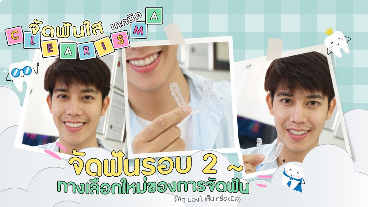 จัดฟันแบบใส Clearisma โปรโมชั่นราคาดัดฟันใสราคาถูก