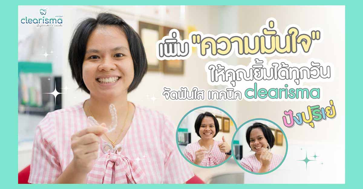 [รีวิวจัดฟันใส] จัดฟันแบบใส สไตล์คนฟันห่าง แค่ 7 เดือน ฟันก็ชิดเรียงสวยแล้ว!