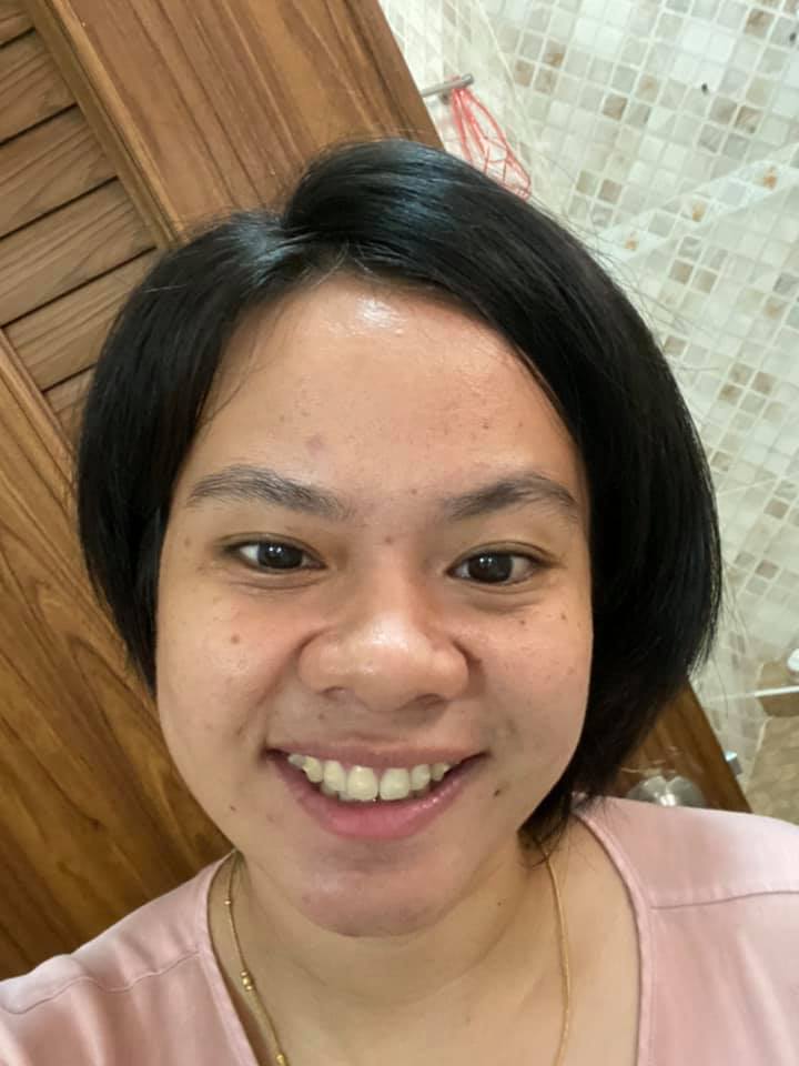 จัดฟัน ดัดฟัน รีวิวจัดฟันแบบใสกรุงเทพ