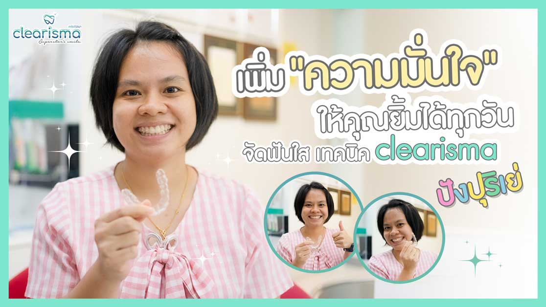รีวิวจัดฟันแบบใส Clearisma ฟันเรียงชิด แก้ฟันห่าง จัดฟันใสแค่ 7 เดือน