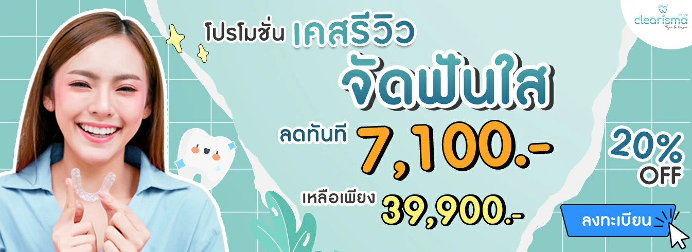 จัดฟันแบบใสผ่อน