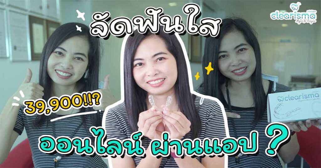 clear-braces-invisible-review