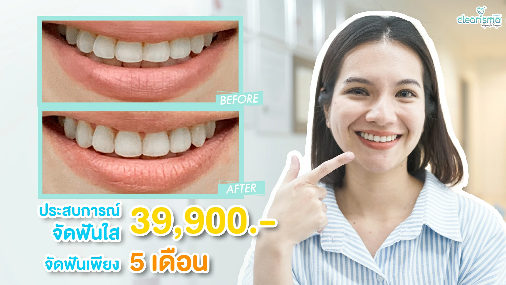 รีวิวจัดฟันใสออนไลน์ไร้กังวลโควิด จัดฟันรอบ 2 ทั้งทีต้องจัดฟันแบบใส รีวิวจัดฟันใสออนไลน์ไร้กังวลโควิด จัดฟันรอบ 2 ทั้งทีต้องจัดฟันแบบใส