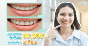 review-clear-braces-clear-aligner