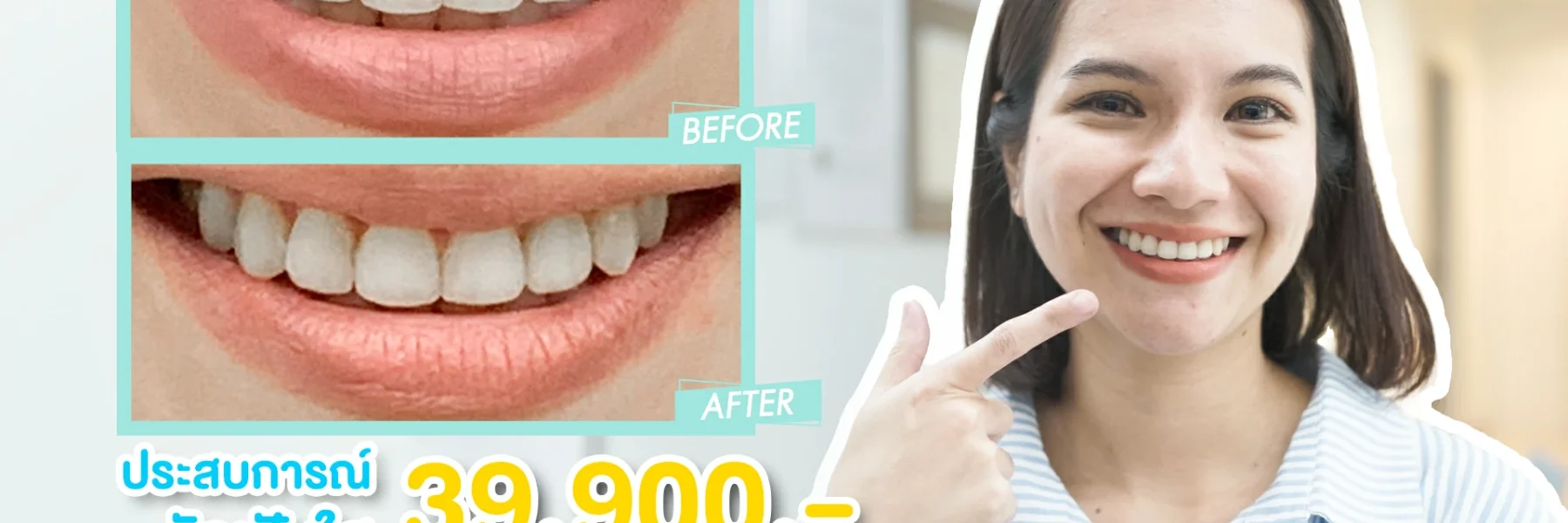 รีวิวจัดฟันแบบใสในช่วงโควิด จัดฟันรอบ 2 จัดฟันราคาถูกไม่ถึงแสน
