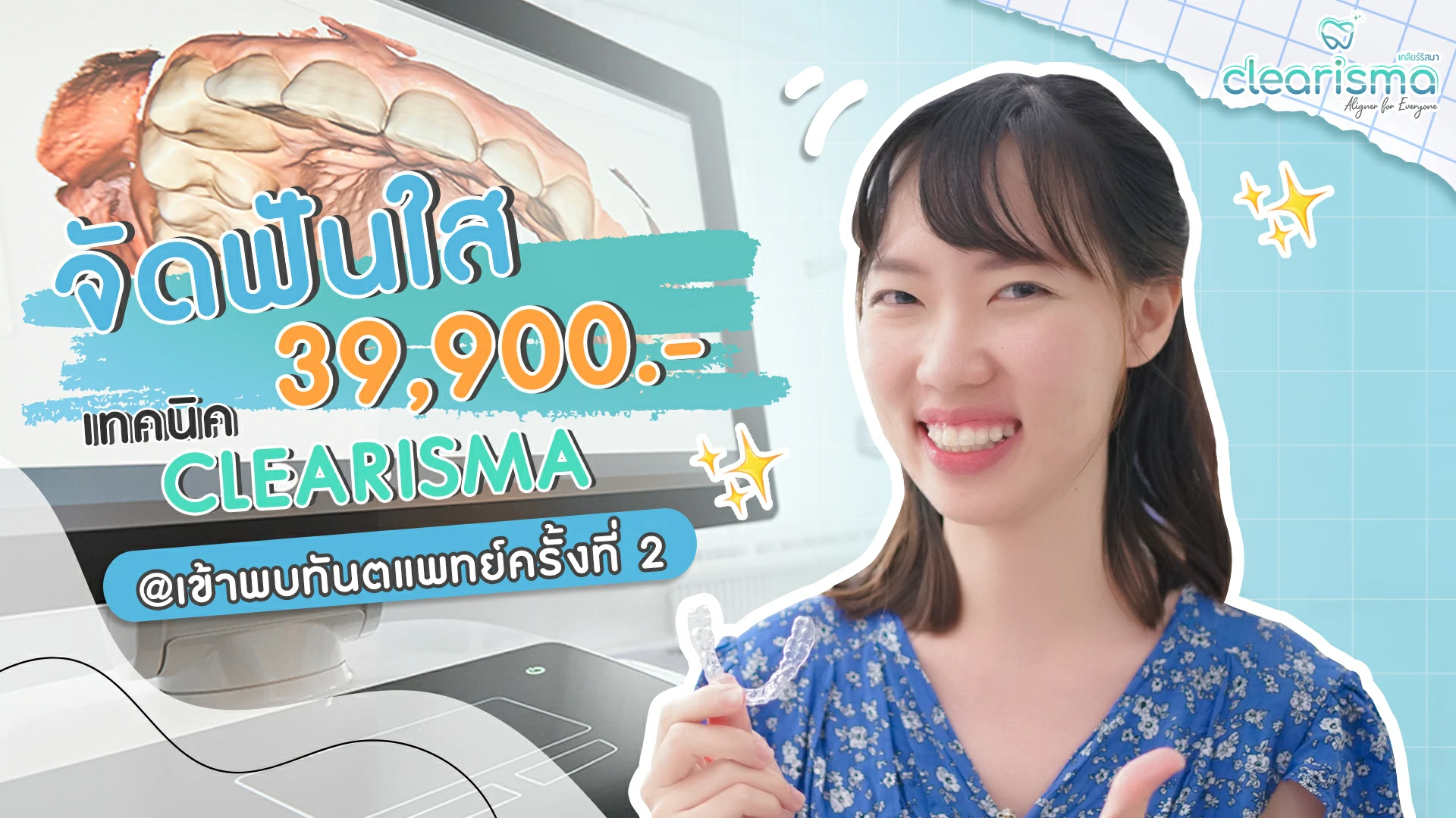 แชร์ประสบการณ์จัดฟันครั้งแรก รีวิวจัดฟันแบบใส แบบไม่ต้องถอนฟัน