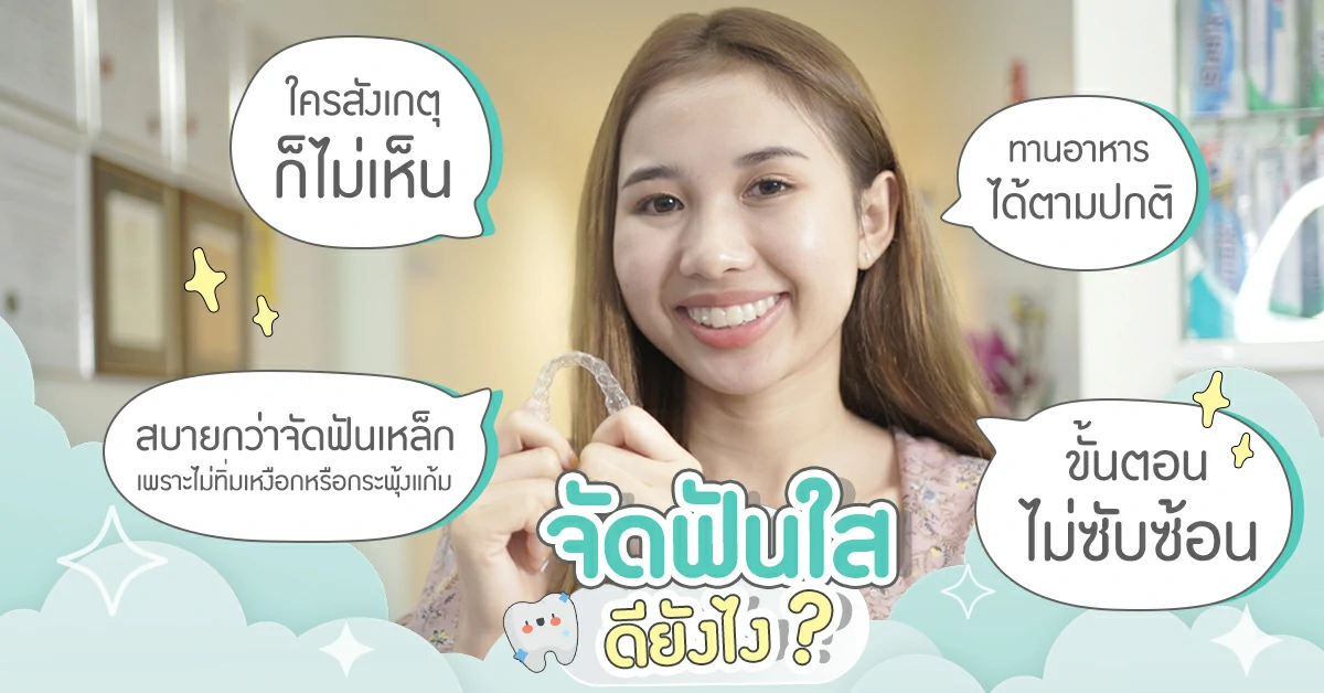 จัดฟันใสดีไหม ข้อดี