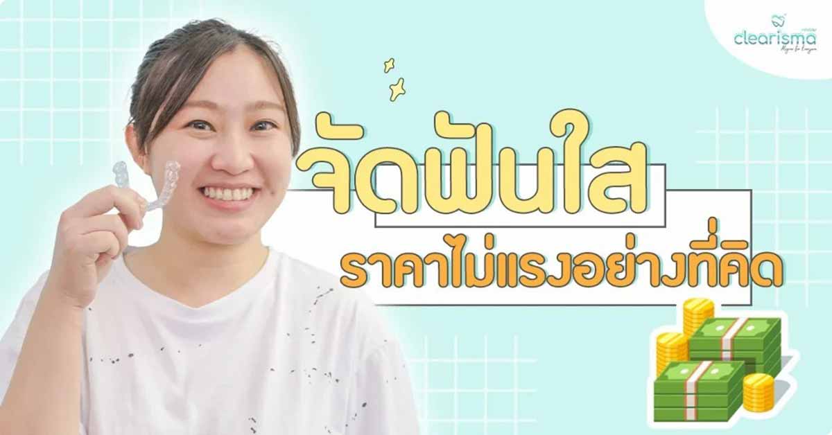 จัดฟันแบบใส ดัดฟันใส ราคาถูกอัพเดตล่าสุด