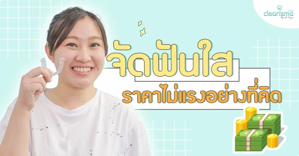 จัดฟันใสราคาไม่แรงอย่างที่คิด