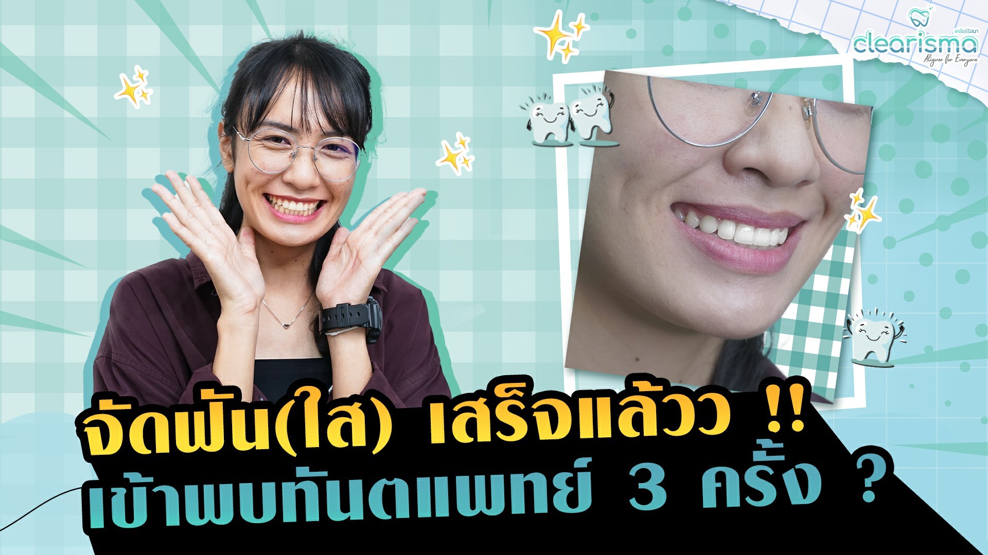 รีวิวจัดฟันแบบใส รีวิวจัดฟันใส รีวิวทำฟันใส