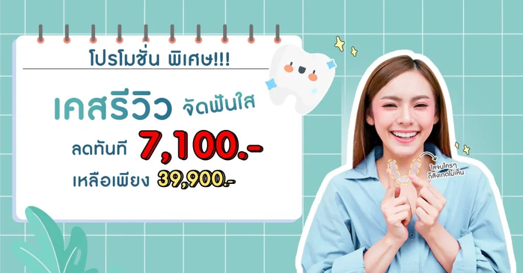 รีวิวจัดฟันแบบใส