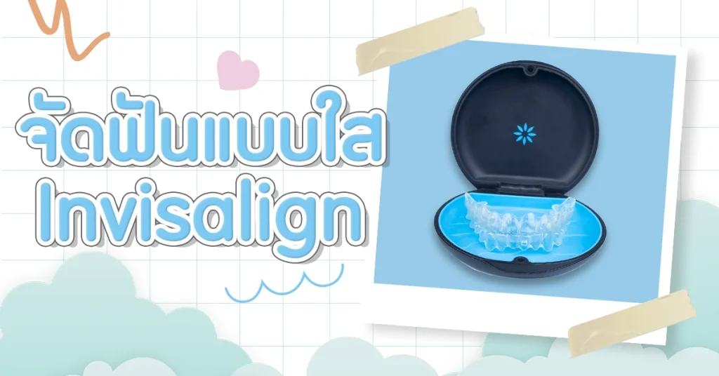 จัดฟันแบบใส จัดฟันinvisalign ดัดฟัน จัดฟันใสinvisalign