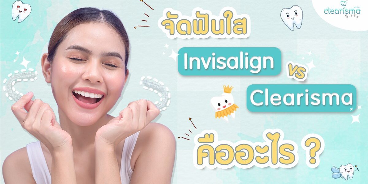 จัดฟันแบบใส จัดฟัน invisalign