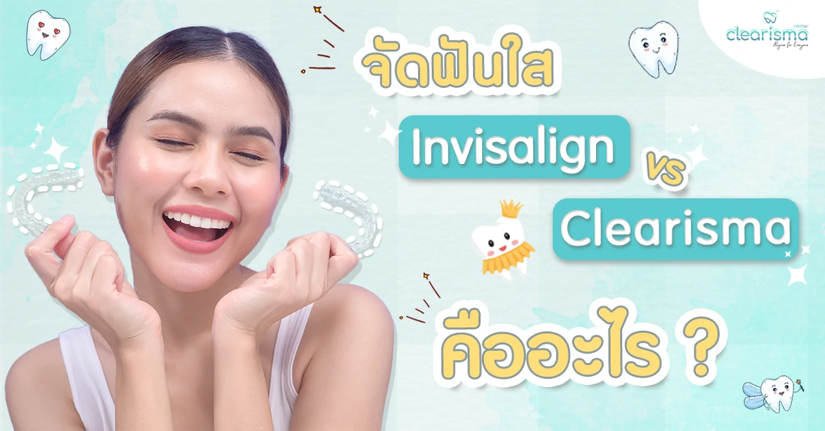 จัดฟันแบบใส จัดฟันinvisalign