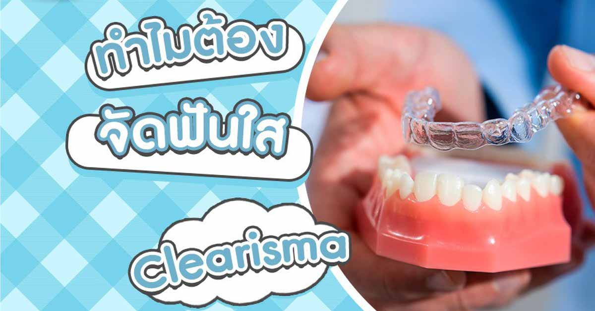 จัดฟันใส ราคาสบาย ทำไมต้องเทคนิค Clearisma