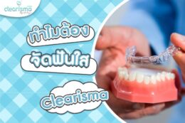 ทำไมต้องจัดฟันใสเทคนิค Clearisma