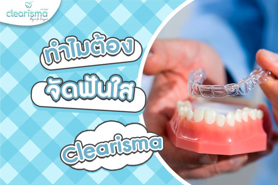 ทำไมต้องจัดฟันใสเทคนิค Clearisma