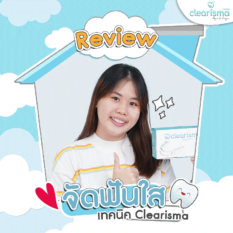 รีวิวจัดฟันใส เทคนิค Clearisma 3