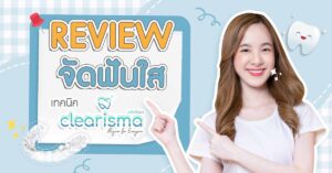 review-aligner-dental