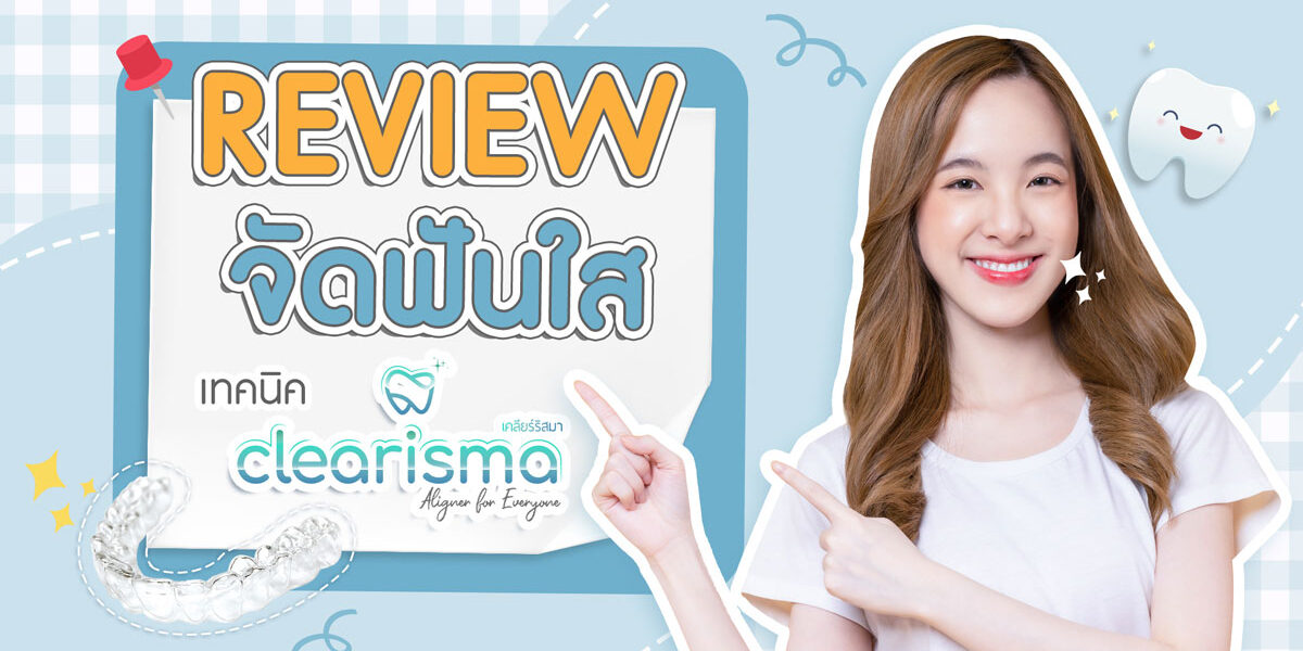 รีวิวจัดฟันแบบใส