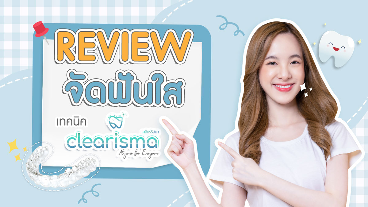 รีวิวจัดฟันแบบใส