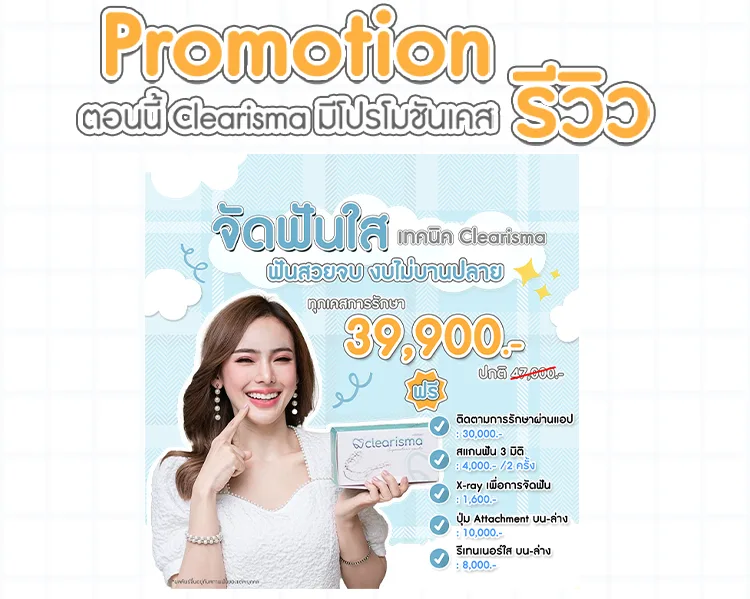 โปรโมชั่นราคาจัดฟันใส
