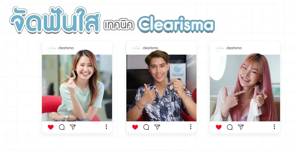 จัดฟันแบบ clearisma