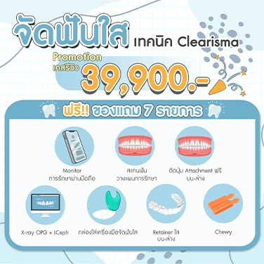 จัดฟันโปรโมชั่น