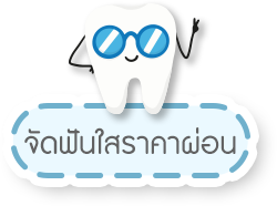 จัดฟันใสราคาผ่อน