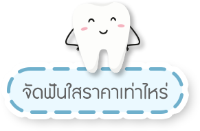 จัดฟันใสราคาเท่าไหร่