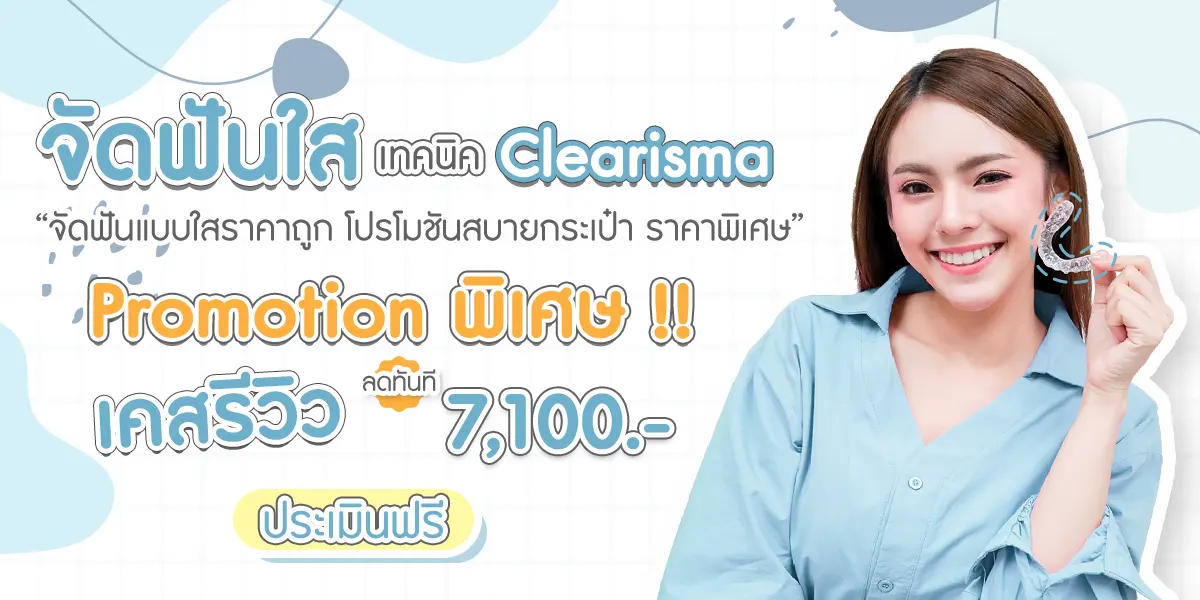 ราคาจัดฟันใส