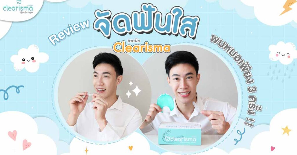 clear-ailgner-review-case-dentist