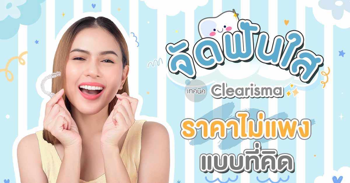 จัดฟันครั้งแรก ต้องจ่ายแพงจริงหรอ ?