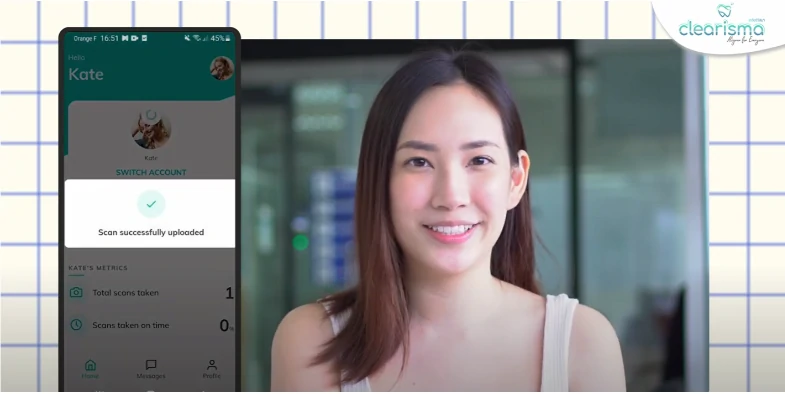 รีวิวจัดฟันแบบใส-รักษาผ่านแอปพลิเคชั่น